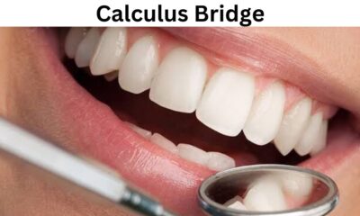 Calculus Bridge